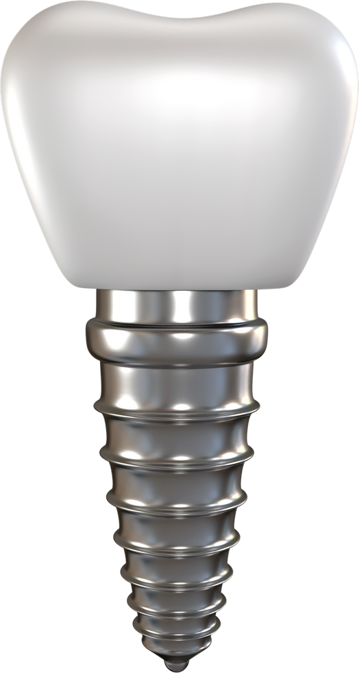 Dental tooth implant 3d render.